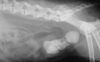 Calcoli nella vescica